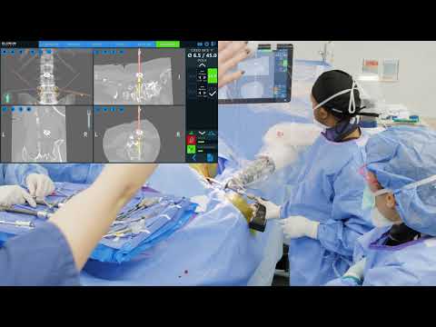 ExcelsiusGPS® Case Workflow Case 1